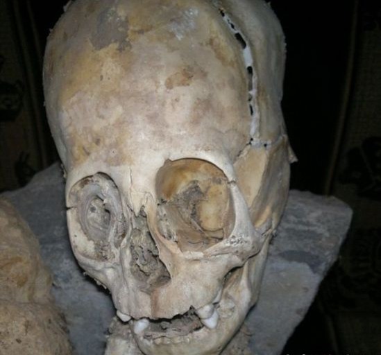 秘鲁巨头干尸疑似外星人遗骨 奇趣发现